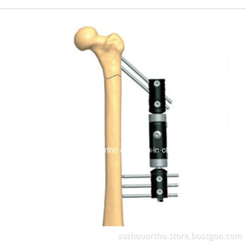 Three Rods and Four Screws